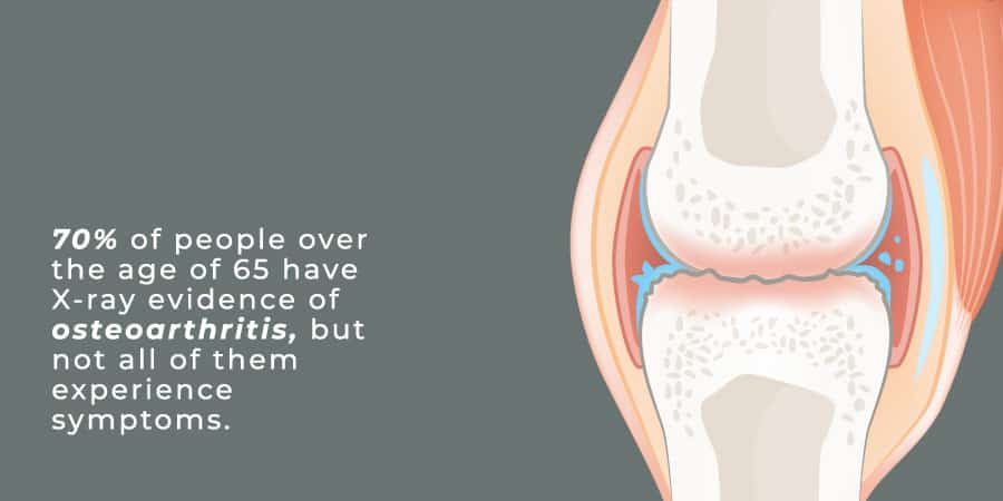 What Is Osteoarthritis - J.Flowers Health Institute